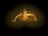 Pain Worm